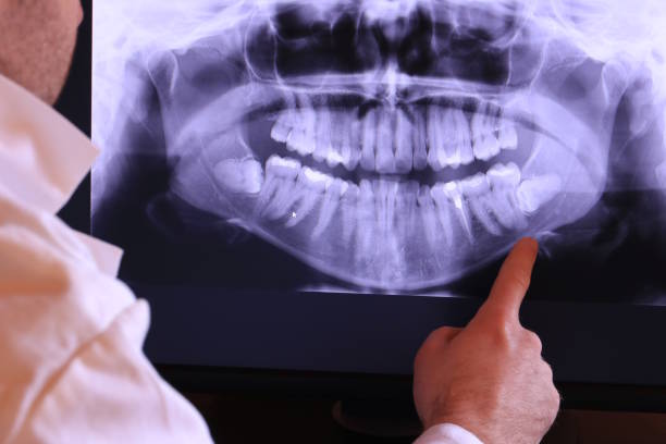 Best Emergency Treatment for Dental Infections or Abscesses in South Charleston, WV