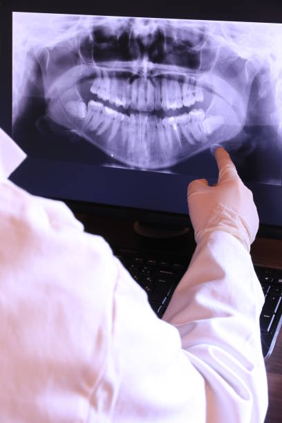 Best Emergency Dental Care for Broken or Chipped Teeth in South Charleston, WV