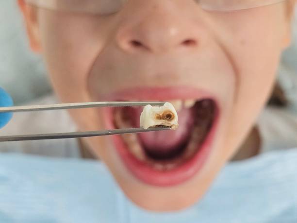Best Same-Day Emergency Dental Services in South Charleston, WV
